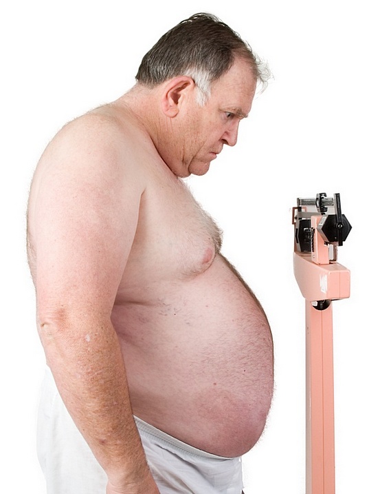 Фото мужское ожирение