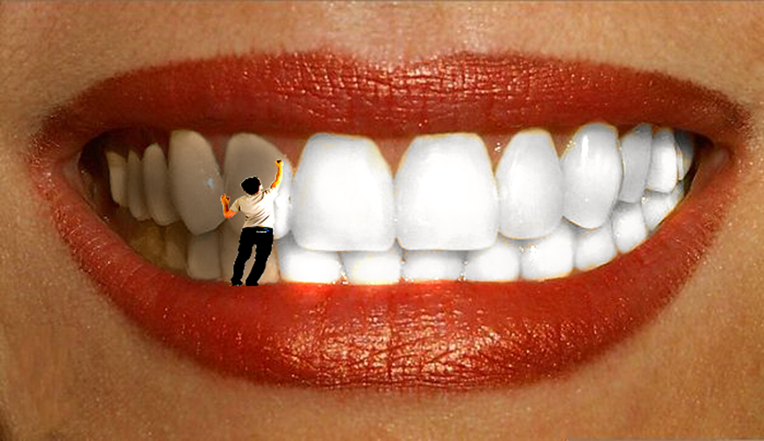 Фото на тему: Подскажите, как отбелить зубы в домашних условиях?